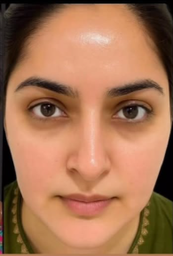 After Skin